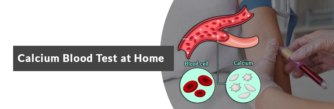 Calcium Blood Test at Home, Symptoms